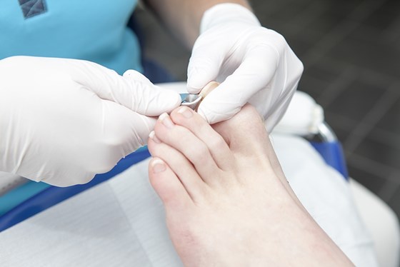 toenail cutting cardiff